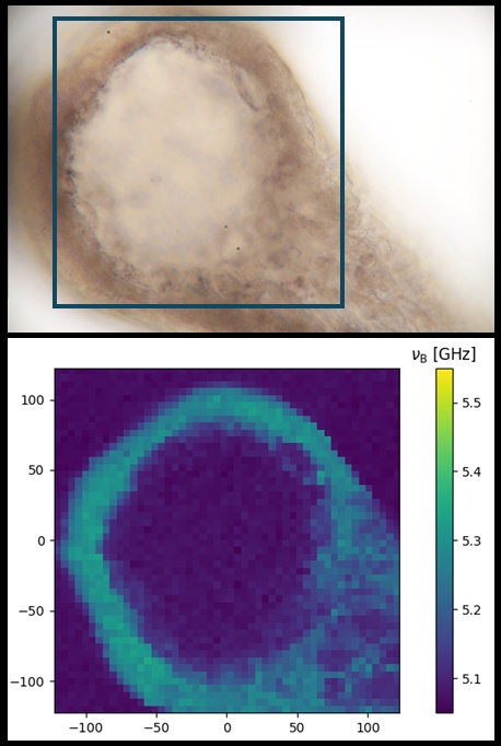 Hydra foot Brillouin scan