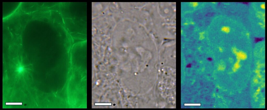 Live cell Brillouin microscopy